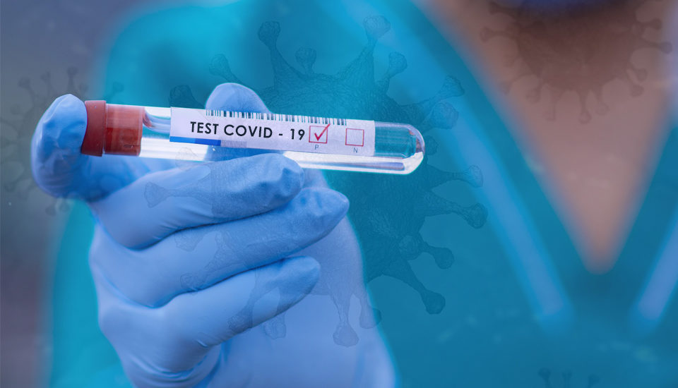 Esecuzione dei test sierologici di tipo IgG e IgM di categoria A per la ricerca di anticorpi anti SARS –CoV-2 (Coronavirus Covid 19).